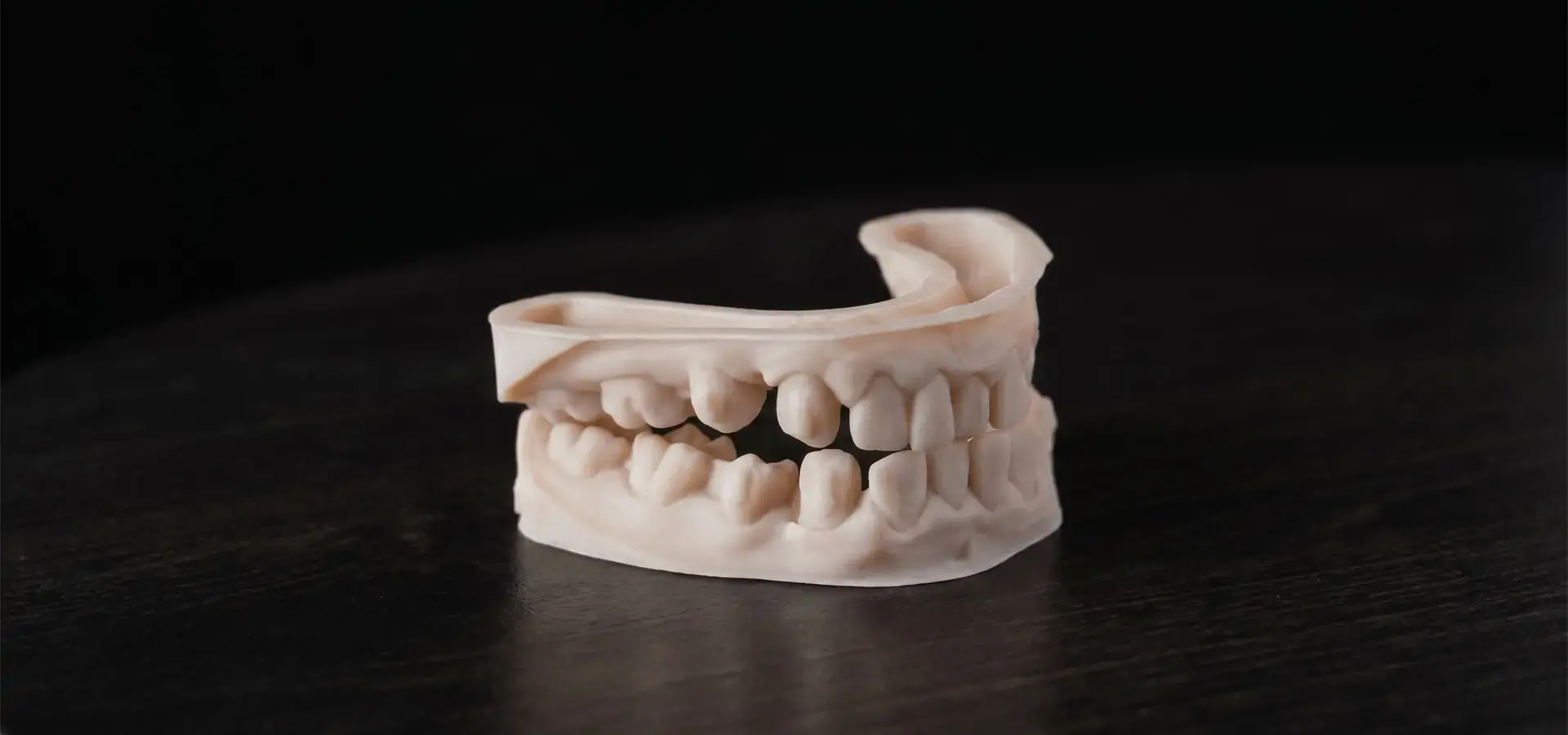 Dental models produced using fast resin 3D printer technology