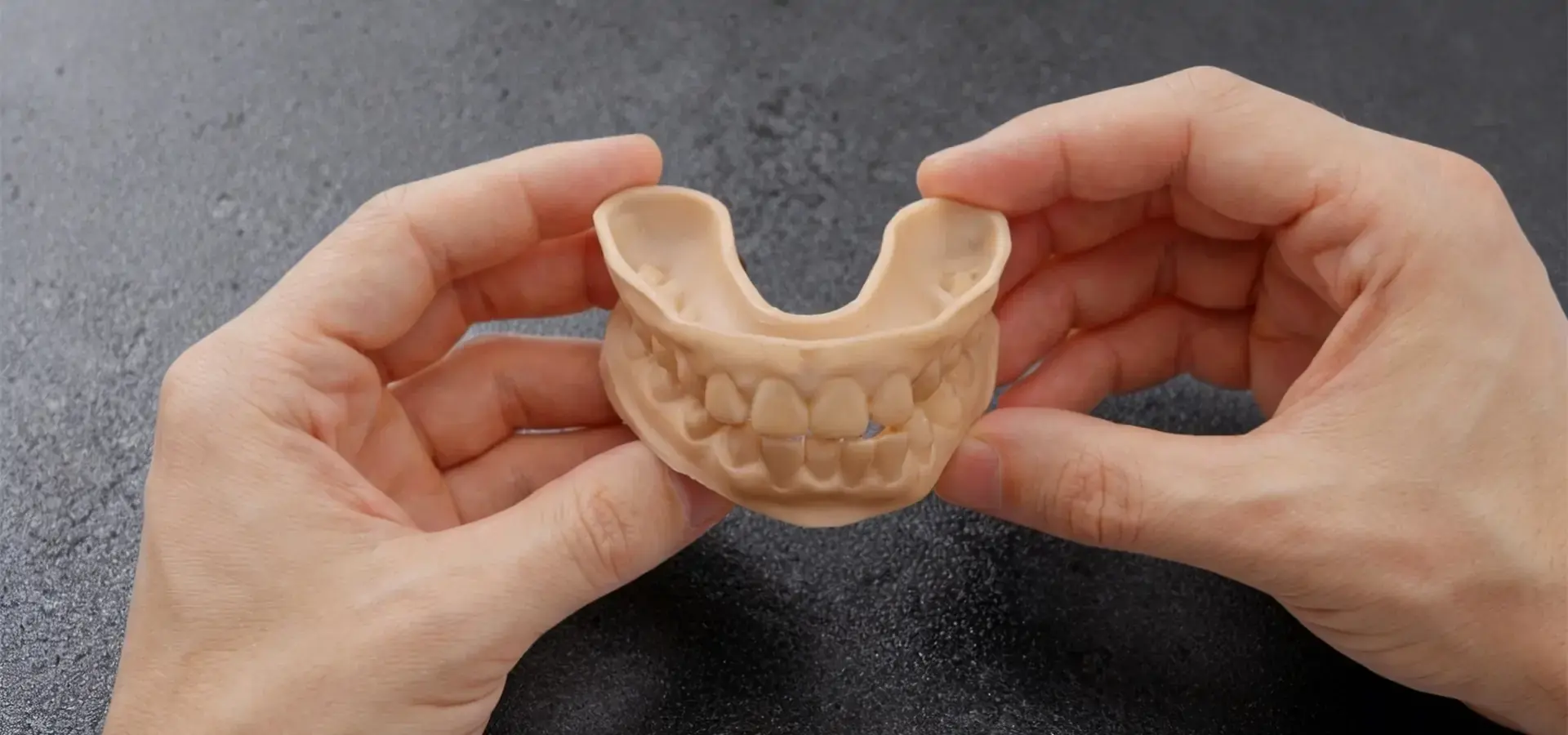 Applications produced by a Budget SLA printer including dental models and resin prototypes