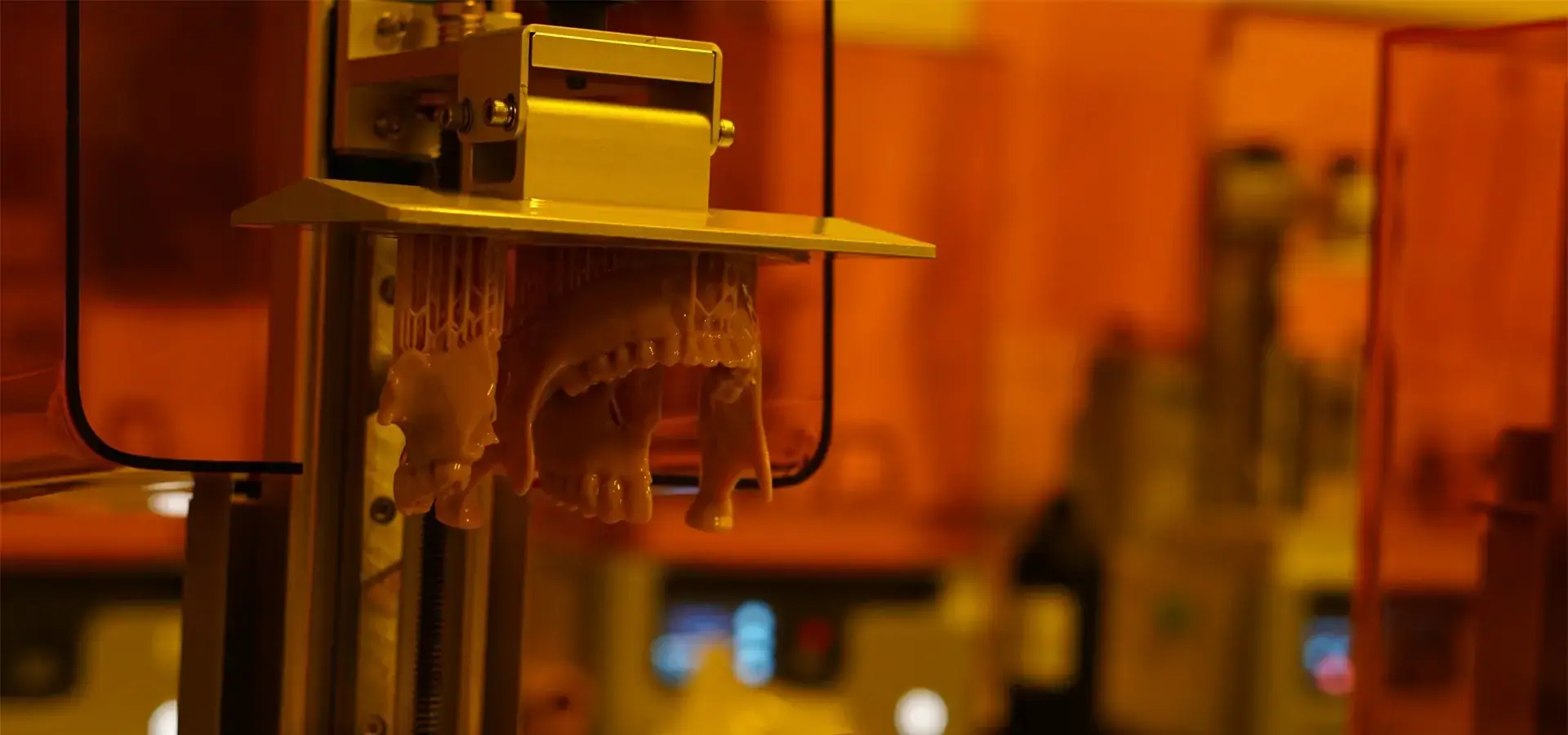 Desktop 3D Printer creating precise dental models and orthodontic applications Desktop 3D Printer creating precise dental models and orthodontic applications